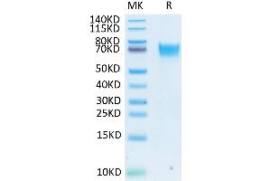 Biotinylated Human FGFR3 alpha (IIIb) on Tris-Bis PAGE under reduced conditions.
