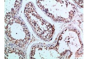 Immunohistochemical analysis of paraffin-embedded Human-testis, antibody was diluted at 1:100 (PIK3R2 抗体  (AA 1-60))