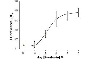 Gastrin-Releasing Peptide (GRP) peptide