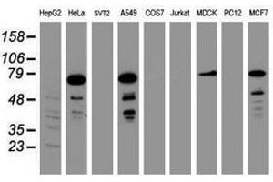 Image no. 2 for anti-Receptor (TNFRSF)-Interacting serine-threonine Kinase 1 (RIPK1) (AA 133-422) antibody (ABIN1490911)