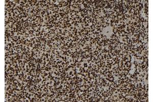 ABIN6267200 at 1/100 staining Mouse spleen tissue by IHC-P. (Topoisomerase II alpha 抗体  (pSer1469))