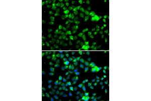 Immunofluorescence analysis of A549 cell using NAA20 antibody. (NAT5 抗体)