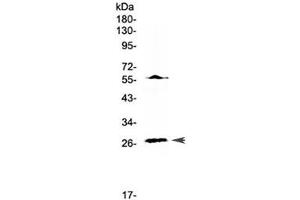 Western blot testing of human Jurkat cell lysate with IL17A antibody at 0. (Interleukin 17a 抗体)