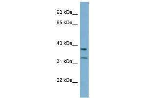 Western Blotting (WB) image for anti-Ral GEF with PH Domain and SH3 Binding Motif 2 (RALGPS2) (N-Term) antibody (ABIN2787055)