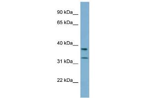 WB Suggested Anti-RALGPS2 Antibody Titration: 0. (RALGPS2 抗体  (N-Term))