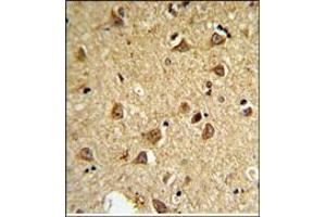 Immunohistochemistry (Paraffin-embedded Sections) (IHC (p)) image for anti-Deiodinase, Iodothyronine, Type II (DIO2) (AA 171-200), (Middle Region) antibody (ABIN453620)