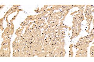 Detection of IL6 in Rat Cardiac Muscle Tissue using Polyclonal Antibody to Interleukin 6 (IL6) (IL-6 抗体  (AA 21-211))