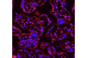 Immunofluorescence of paraffin embedded human placenta using Neil1 (ABIN7073820) at dilution of 1: 300 (400x lens) (NEIL1 抗体)