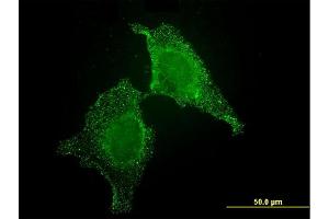 Immunofluorescence of monoclonal antibody to CIB1 on HeLa cell. (CIB1 抗体  (AA 1-191))