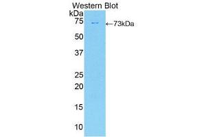 Western Blotting (WB) image for anti-Deiodinase, Iodothyronine, Type II (DIO2) (AA 30-259) antibody (ABIN1858637) (DIO2 抗体  (AA 30-259))