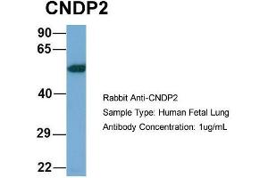 Host: Rabbit  Target Name: CNDP2  Sample Tissue: Human Fetal Lung  Antibody Dilution: 1. (CNDP2 抗体  (Middle Region))