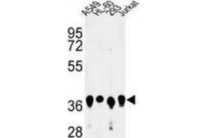 Western Blotting (WB) image for anti-Arginine and Glutamate Rich 1 (ARGLU1) antibody (ABIN3004117) (ARGLU1 抗体)