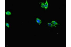 Immunofluorescent analysis of Hela cells using ABIN7167229 at dilution of 1:100 and Alexa Fluor 488-congugated AffiniPure Goat Anti-Rabbit IgG(H+L) (RAB12 抗体  (AA 98-241))