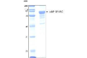 10% SDS-PAGE stained with Coomassie Blue (CB) and peptide fingerprinting by MALDI-TOF mass spectrometry (SPARC Protein (AA 1-303) (MBP tag))