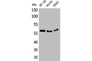 Western Blot analysis of HT29 HuvEc K562 cells using CYP11B1/2 Polyclonal Antibody (CYP11B1 抗体  (N-Term))