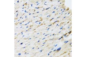 Immunohistochemistry (Paraffin-embedded Sections) (IHC (p)) image for anti-V-Raf-1 Murine Leukemia Viral Oncogene Homolog 1 (RAF1) (AA 190-350) antibody (ABIN3020713)