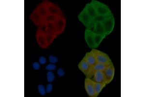 ABIN6261286 and ABIN6272287 staining Hela cells(24h of starvation treatment) by IF/ICC.