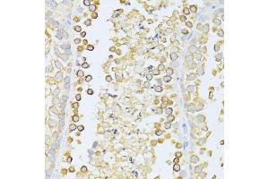 Immunohistochemistry of paraffin-embedded mouse testis using MAP1LC3B antibody. (LC3B 抗体)
