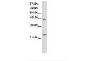 Image no. 1 for anti-Chromobox Homolog 6 (CBX6) (N-Term) antibody (ABIN202464) (CBX6 抗体  (N-Term))