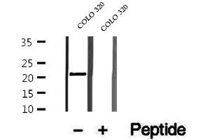 Western blot analysis of extracts of COLO 320 cells, using OBFC2A antibody. (OBFC2A 抗体  (Internal Region))