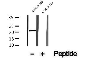 Western blot analysis of extracts of COLO 320 cells, using OBFC2A antibody. (OBFC2A 抗体  (Internal Region))