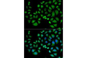 Immunofluorescence analysis of HeLa cell using CLIC1 antibody. (CLIC1 抗体)