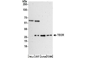 Western Blotting (WB) image for anti-Trans-2,3-Enoyl-CoA Reductase (TECR) (AA 200-250) antibody (ABIN7453216)
