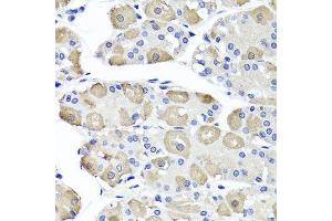 Immunohistochemistry of paraffin-embedded human stomach using OTC antibody. (OTC 抗体  (AA 215-354))