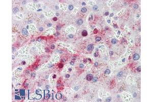 Immunohistochemistry (IHC) image for anti-Methylenetetrahydrofolate Dehydrogenase (NADP+ Dependent) 1, Methenyltetrahydrofolate Cyclohydrolase, Formyltetrahydrofolate Synthetase (MTHFD1) (Internal Region) antibody (ABIN308408)