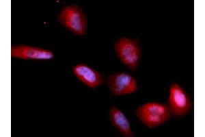 Immunofluorescence (IF) image for anti-CD33 (CD33) (AA 18-259) antibody (PE) (ABIN5567445) (CD33 抗体  (AA 18-259) (PE))