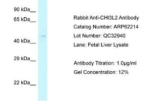 Western Blotting (WB) image for anti-Chitinase 3-Like 2 (CHI3L2) (Middle Region) antibody (ABIN2789065) (CHI3L2 抗体  (Middle Region))