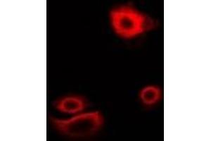 Immunofluorescent analysis of Myotilin staining in U2OS cells. (Myotilin 抗体)