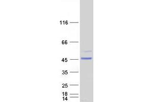 Western Blotting (WB) image for Armadillo Repeat Containing 8 (ARMC8) (Transcript Variant 3) protein (Myc-DYKDDDDK Tag) (ABIN2714928)