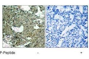 Image no. 3 for anti-Mitogen-Activated Protein Kinase Kinase 1 (MAP2K1) (pSer221), (pSer222) antibody (ABIN196888) (MEK1 抗体  (pSer221, pSer222))