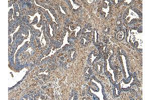 Immunohistochemistry (IHC) image for anti-Vacuolar Protein Sorting 35 (VPS35) (C-Term) antibody (ABIN185182)