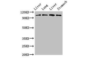 Western Blot Positive WB detected in: Rat liver tissue, Rat lung tissue, Mouse liver tissue, Mouse stomach tissue All lanes: MAP3K13 antibody at 3 μg/mL Secondary Goat polyclonal to rabbit IgG at 1/50000 dilution Predicted band size: 109, 18, 93, 86, 15 kDa Observed band size: 109 kDa (MAP3K13 抗体  (AA 506-835))