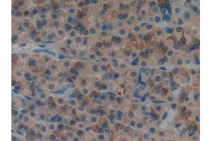 DAB staining on IHC-P; Samples: Rat Stomach Tissue (MYO1F 抗体  (AA 655-922))