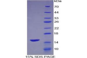 SDS-PAGE analysis of Human Glucose Transporter 14 Protein. (SLC2A14 蛋白)