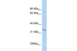 WB Suggested Anti-KHK Antibody  Titration: 1 ug/ml Positive Control: Fetal liver cell lysate (Ketohexokinase 抗体  (C-Term))