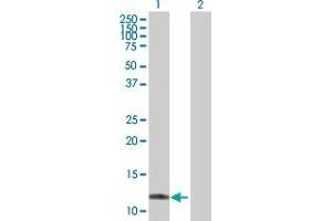 Western Blot analysis of TTLL3 expression in transfected 293T cell line by TTLL3 MaxPab polyclonal antibody. (TTLL3 抗体  (AA 1-101))