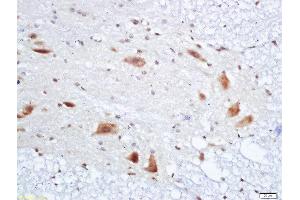 Formalin-fixed and paraffin embedded rat spinal cord labeled with Anti-PMP22 Polyclonal Antibody, Unconjugated  at 1:200 followed by conjugation to the secondary antibody and DAB staining (PMP22 抗体  (AA 101-160))