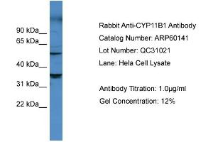 Western Blotting (WB) image for anti-Cytochrome P450, Family 11, Subfamily B, Polypeptide 1 (CYP11B1) (Middle Region) antibody (ABIN2788350)