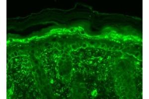 Immunohistochemistry (IHC) image for anti-Transient Receptor Potential Cation Channel, Subfamily V, Member 3 (TRPV3) (AA 458-474) antibody (ABIN863127)