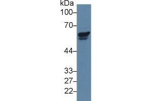 Western Blot; Sample: Human Jurkat cell lysate; Primary Ab: 5µg/ml Rabbit Anti-Human PAK2 Antibody Second Ab: 0. (PAK2 抗体  (AA 177-419))