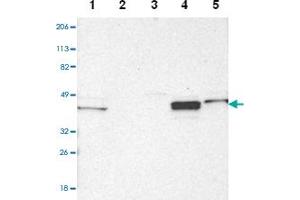 Western blot analysis of Lane 1: Human cell line RT-4, Lane 2: Human cell line U-251MG sp, Lane 3: Human cell line A-431, Lane 4: Human liver tissue, Lane5: Human tonsil tissue with NDRG2 polyclonal antibody  at 1:2500-1:5000 dilution. (NDRG2 抗体)