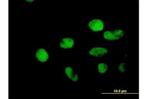 Immunofluorescence of purified MaxPab antibody to MSH2 on HeLa cell. (MSH2 抗体  (AA 1-934))