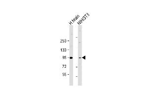 All lanes : Anti-PRKD2 Antibody (Center) at 1:2000 dilution Lane 1: human brain lysate Lane 2: NIH/3T3 whole cell lysate Lysates/proteins at 20 μg per lane. (PKD2 抗体  (AA 556-590))