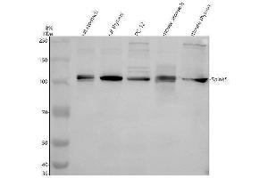Western blot analysis of SPINK5 using anti-SPINK5 antibody (ABIN7825798).