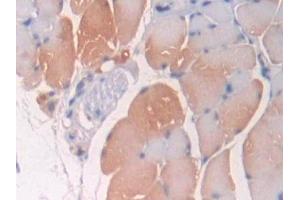 Detection of OPTN in Mouse Skeletal muscle Tissue using Polyclonal Antibody to Optineurin (OPTN) (OPTN 抗体  (AA 1-300))