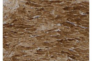 ABIN6264158 and ABIN6272860 at 1/100 staining Rat heart tissue by IHC-P. (PFKFB3 抗体  (C-Term))